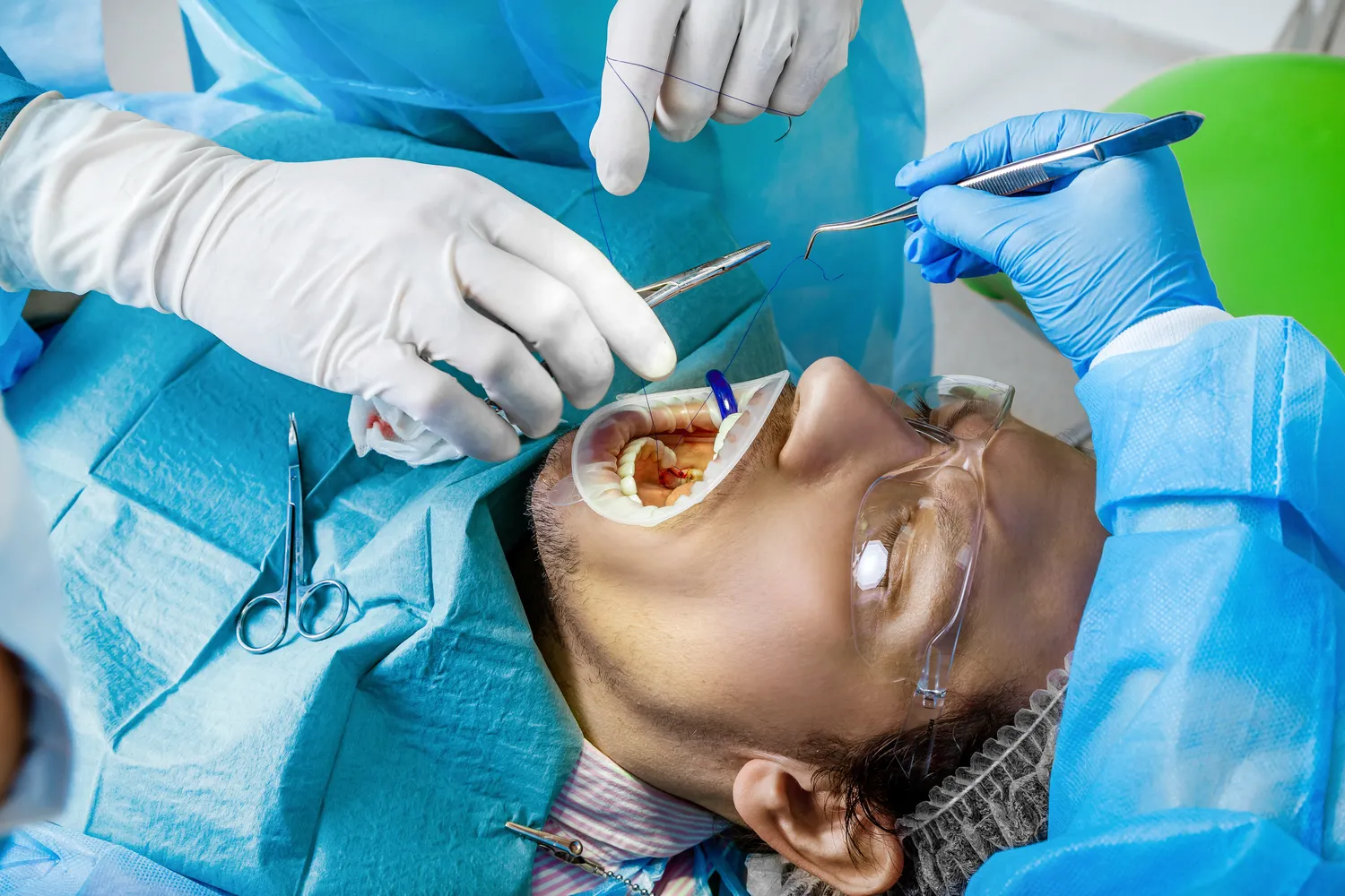 E recepta ile kosztuje?