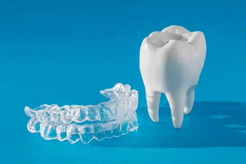 Aparat nakładkowy Invisalign