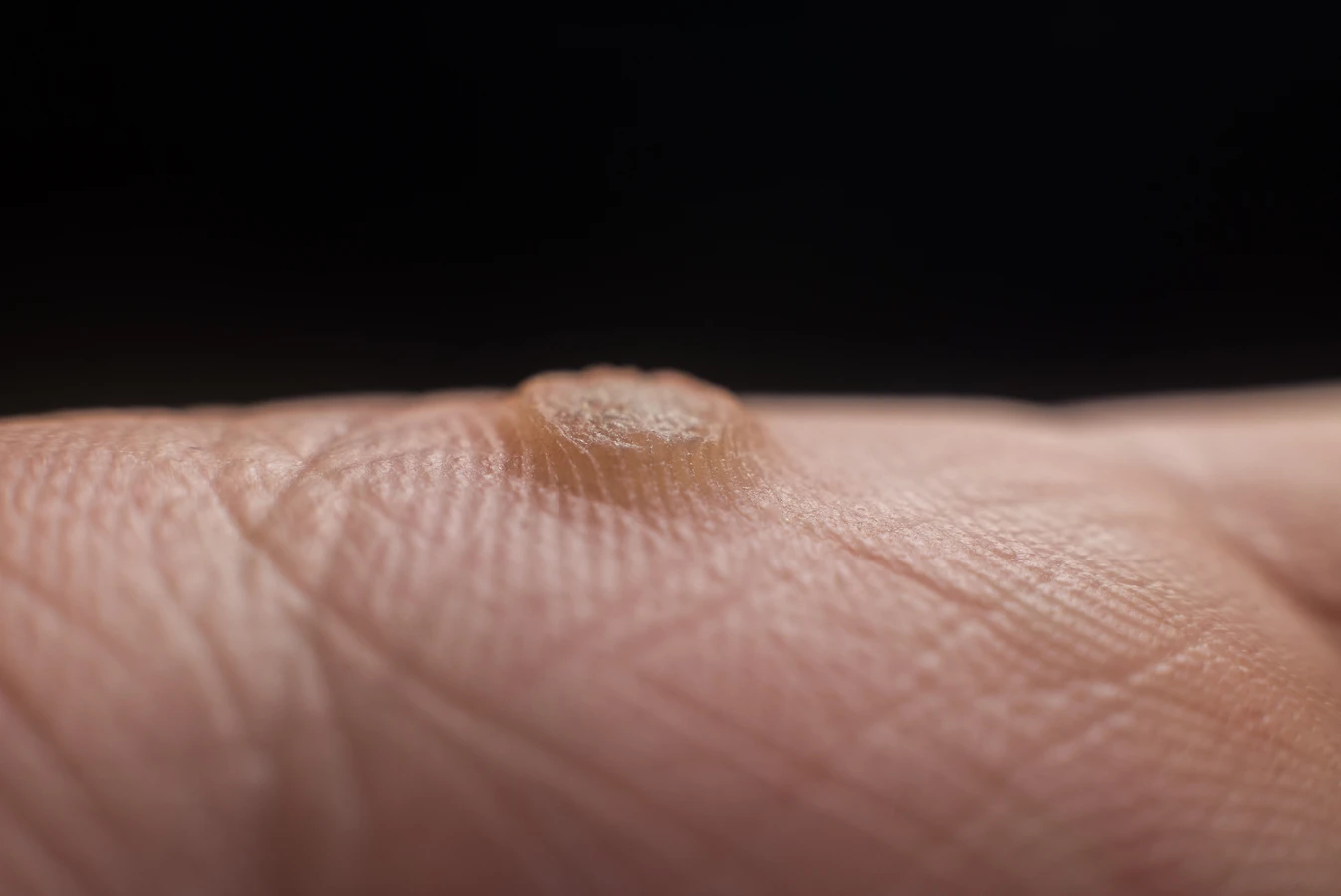 Na problemy ze stopami - podologia