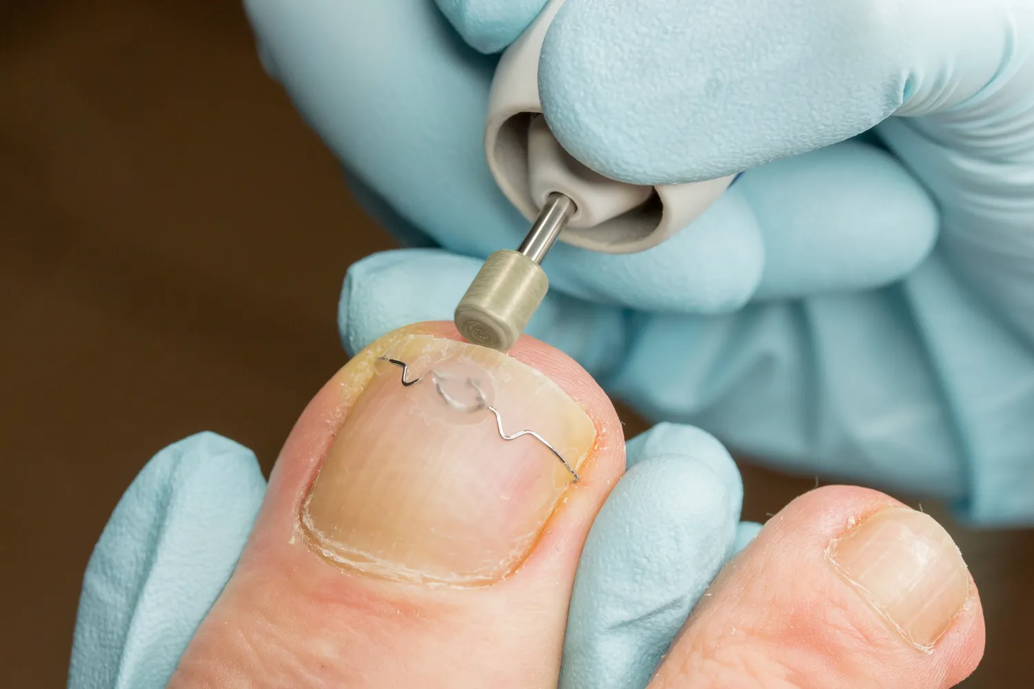 Podologia - zdrowe stopy